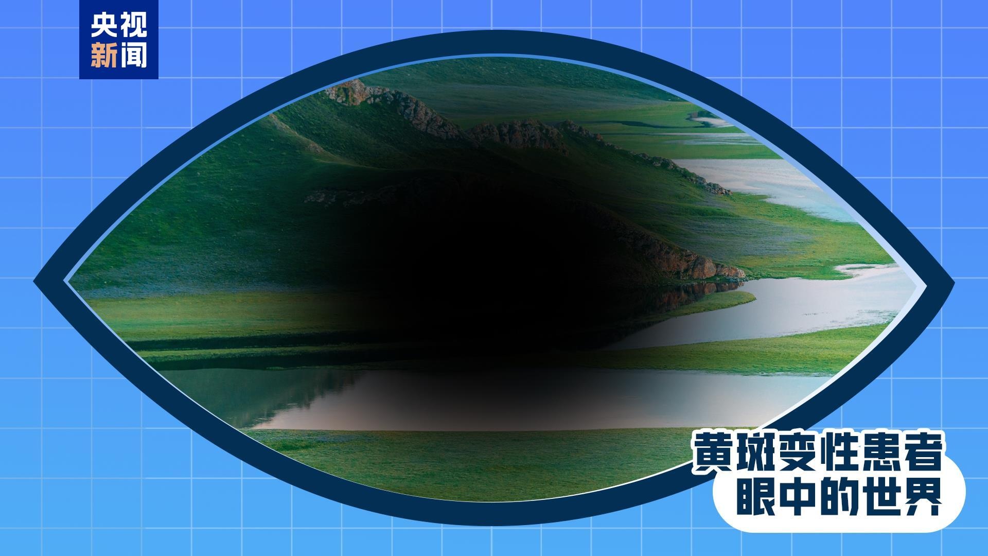 全国爱眼日丨出现这些症状 是眼睛在报警！